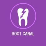Root Canal Treatment In bangalore