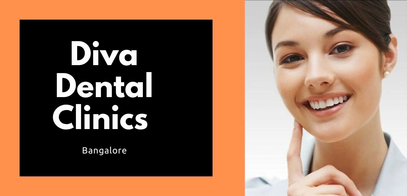 Diva Dental Clinics Bangalore