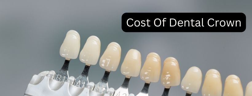 Cost Of Dental Crown
